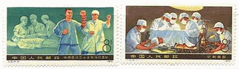 中国の医療と衛生科学の新業績　手の接合手術、白内障の治療、骨折の治療、針麻酔（１９７６年,T12）